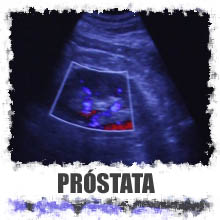 Información de la próstata